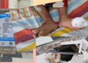 Kecelakaan di Proyek Pedestrian Seputaran Kota Takengon, Satu Warga Dapat 28 Jahit